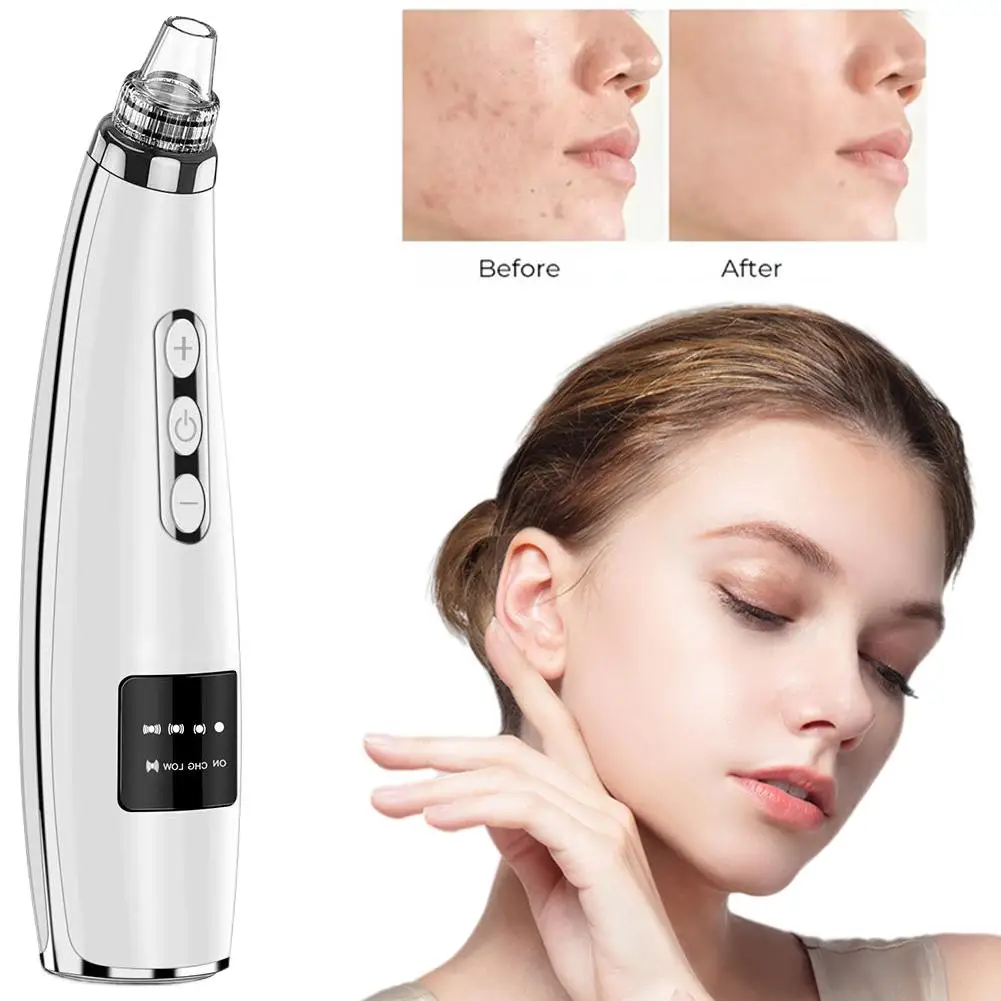 USB Rechargeable Facial Pore Cleaner